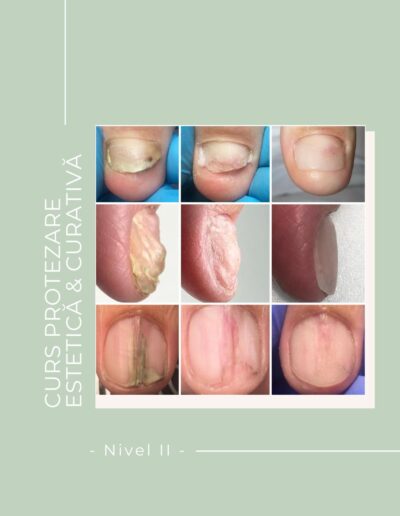 Curs PROTEZARE ESTETICA SI CURATIVA – Nivel II