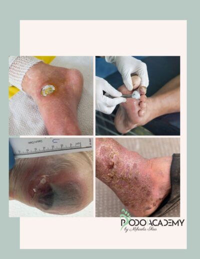 CURS POSTUROLOGIE PODALICA – Modul I