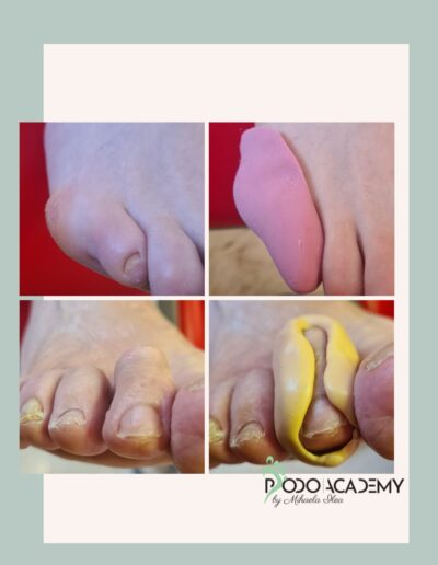 CURS POSTUROLOGIE PODALICA – Modul I