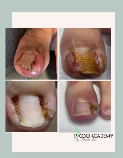 CURS PODOLOGIE – Modul I – Biomecanica piciorului și posturologia aplicată- Prof. M. Volpini